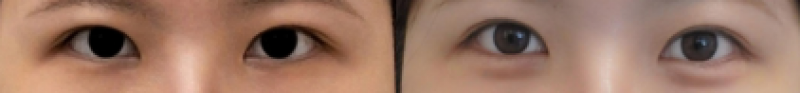 애교필러 벨로테로1CC